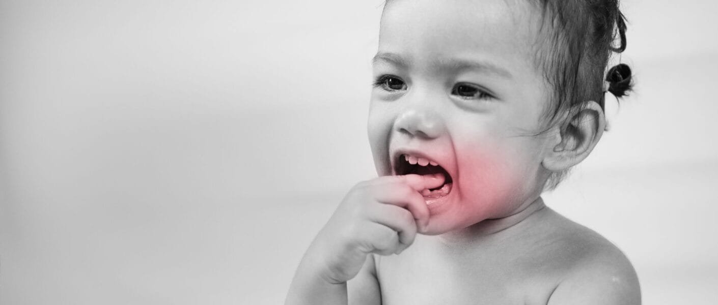 Como Aliviar o Desconforto da Dentição