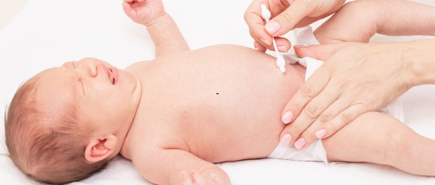 umbigo do recém-nascido