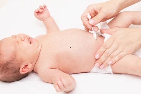 umbigo do recém-nascido