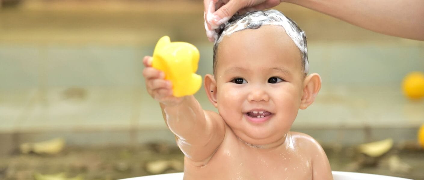 bebê tem descamação na cabeça