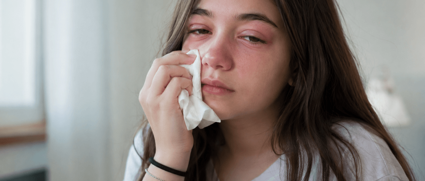 Quando o Medicamento Causa Alergia: Saiba Como Agir