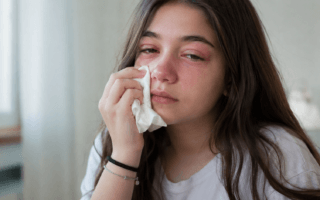 Quando o Medicamento Causa Alergia: Saiba Como Agir