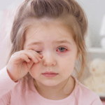 Criança coçando os olhos o tempo todo: alergia ou conjuntivite?