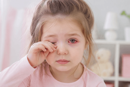 Criança coçando os olhos o tempo todo: alergia ou conjuntivite?